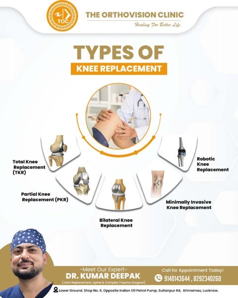Types of Knee Replacement: TKR, Partial, Bilateral & More