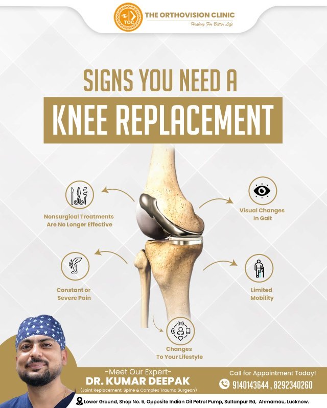 Signs you need a knee replacement