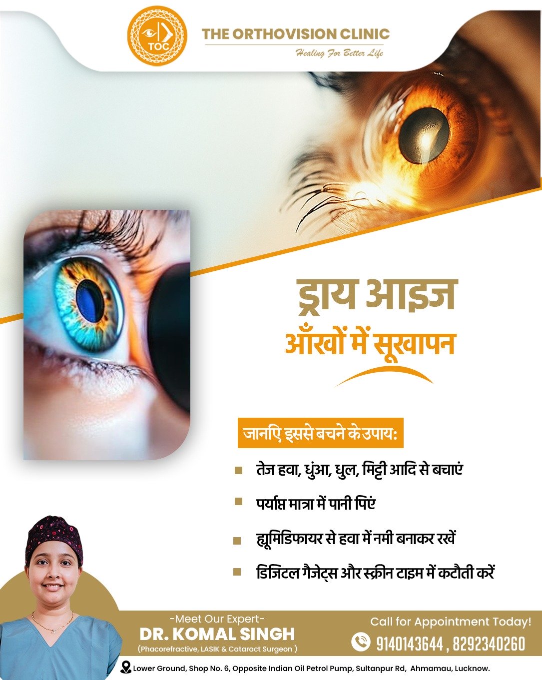 Dry eyes prevention tips
