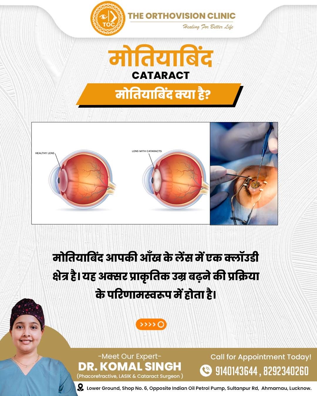 What is cataract educational banner
