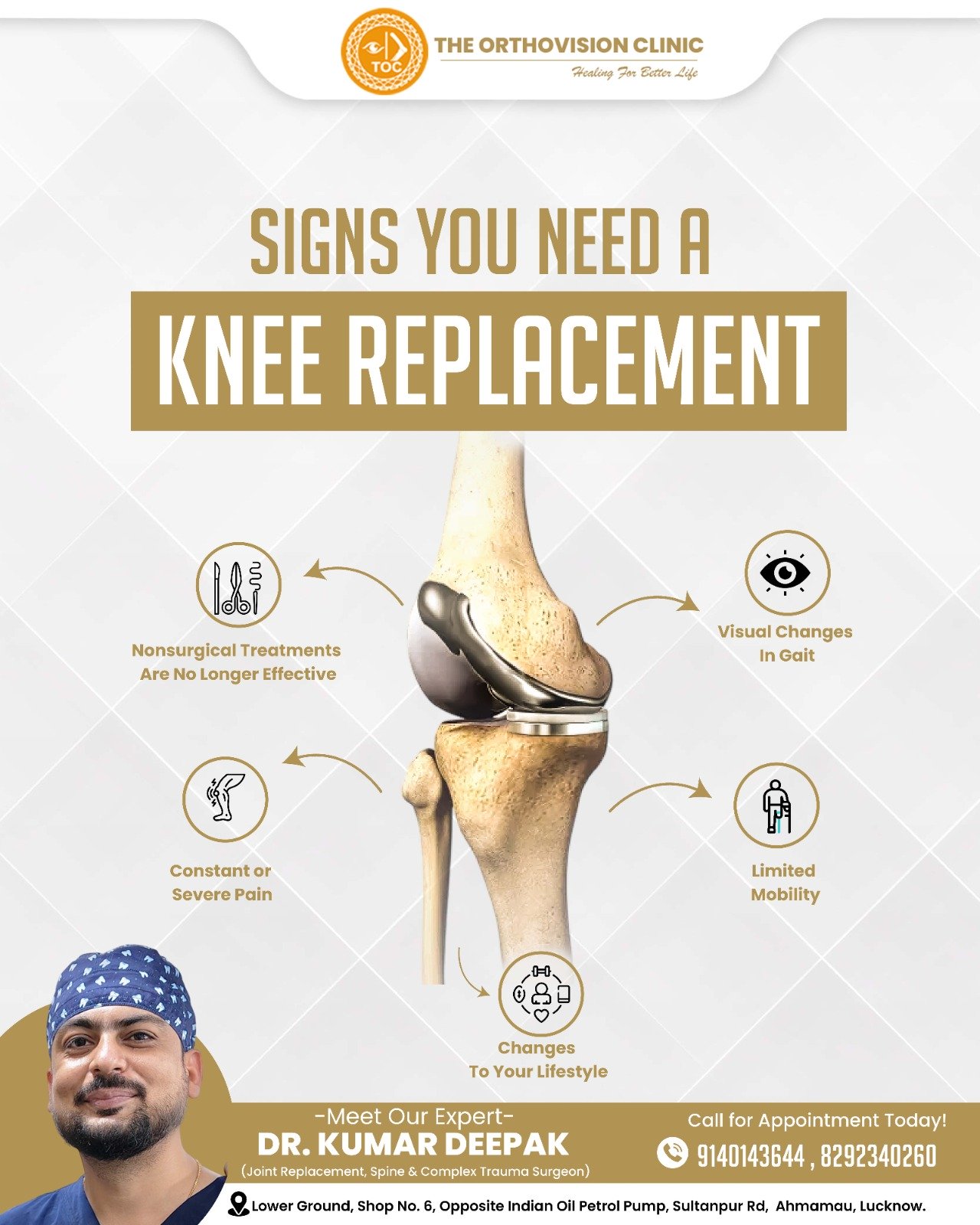 Signs you may need knee replacement