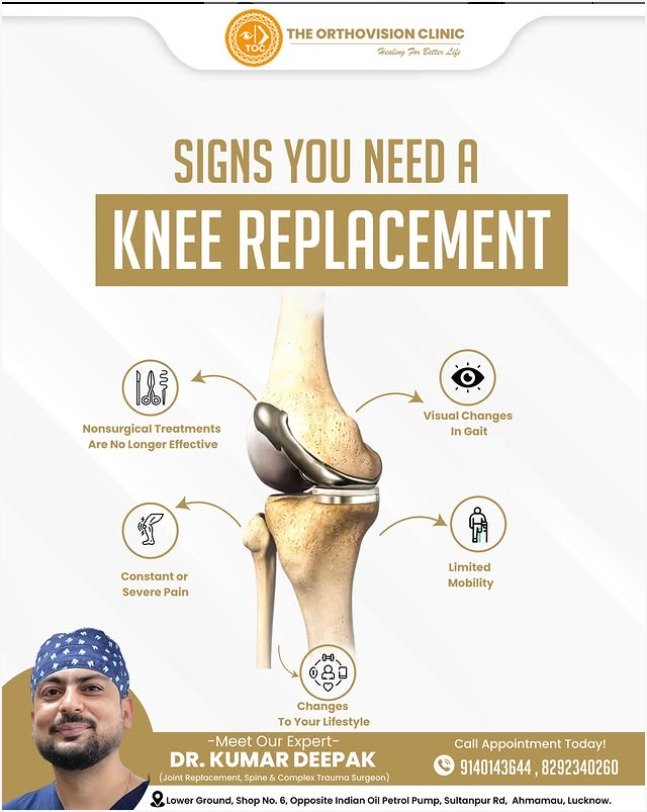 Knee replacement signs and guidance